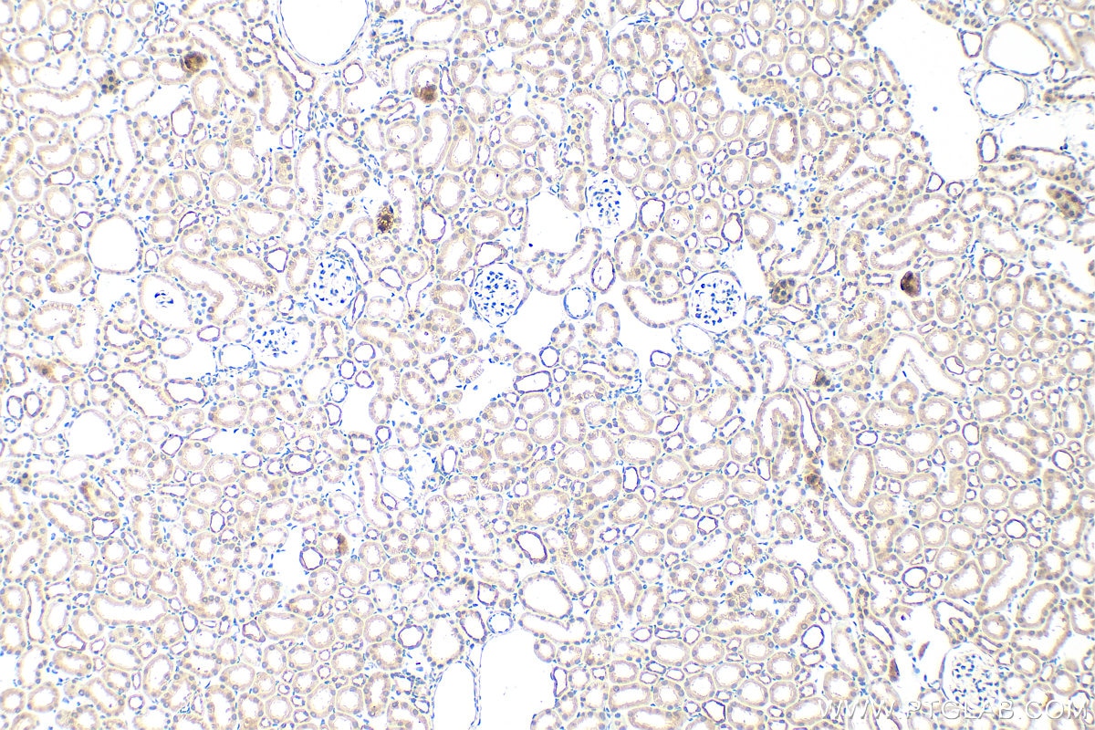 Immunohistochemistry (IHC) staining of mouse kidney tissue using TM9SF1 Polyclonal antibody (16893-1-AP)