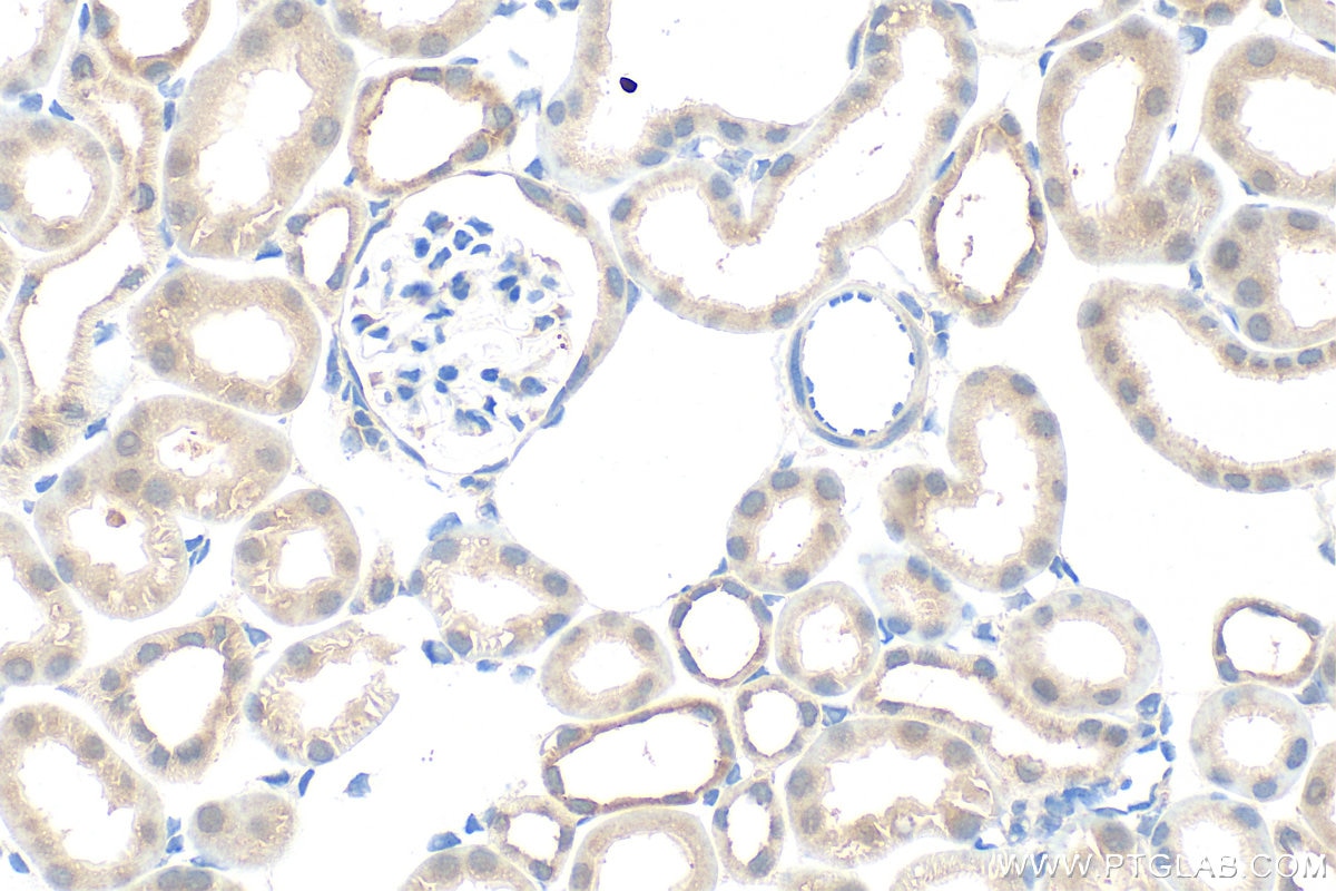 Immunohistochemistry (IHC) staining of mouse kidney tissue using TM9SF1 Polyclonal antibody (16893-1-AP)