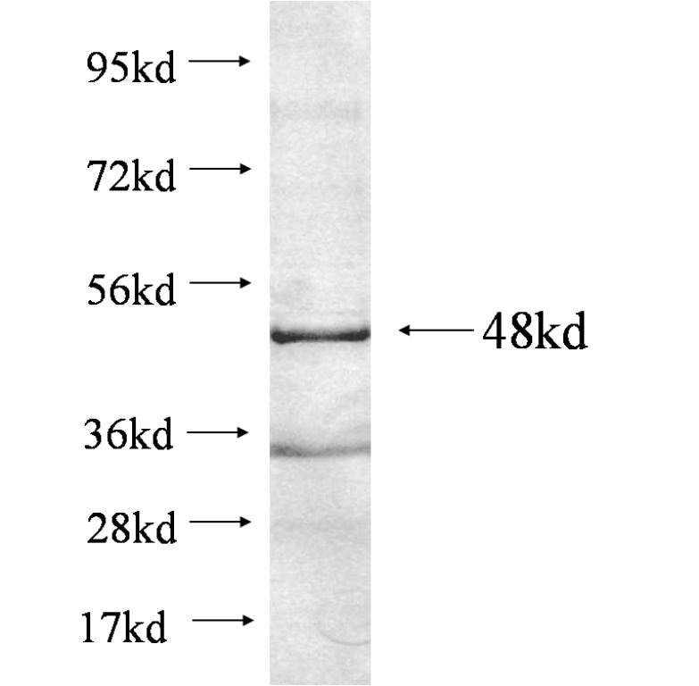 TM9SF1 fusion protein Ag10418 SDS-PAGE