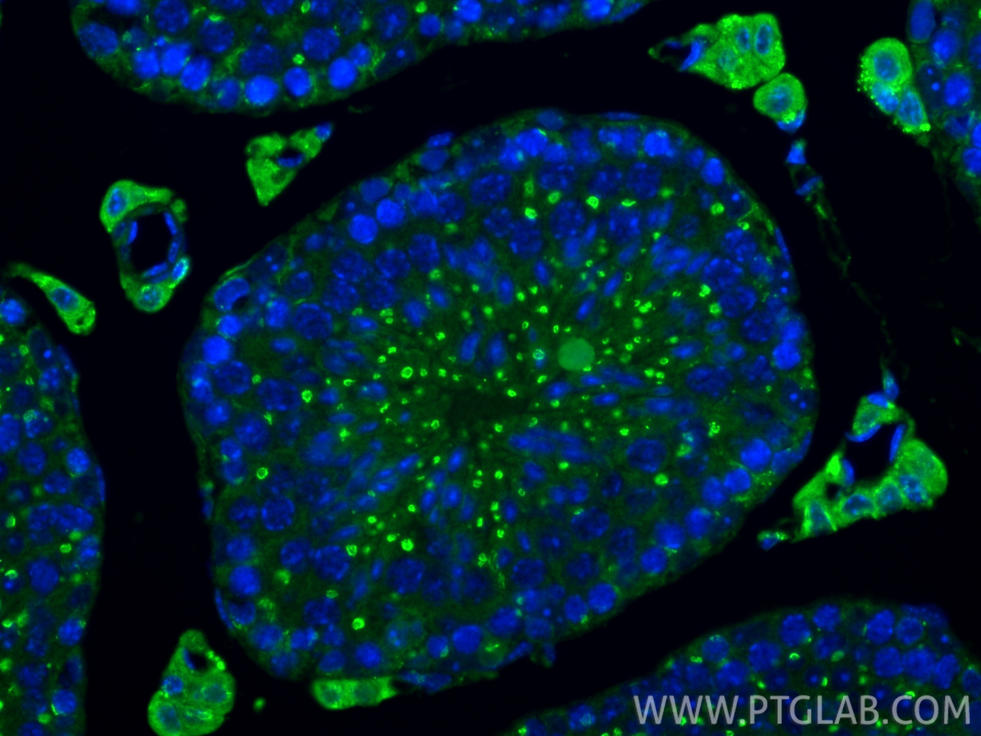 Immunofluorescence (IF) / fluorescent staining of mouse testis tissue using TM9SF3 Polyclonal antibody (17093-1-AP)