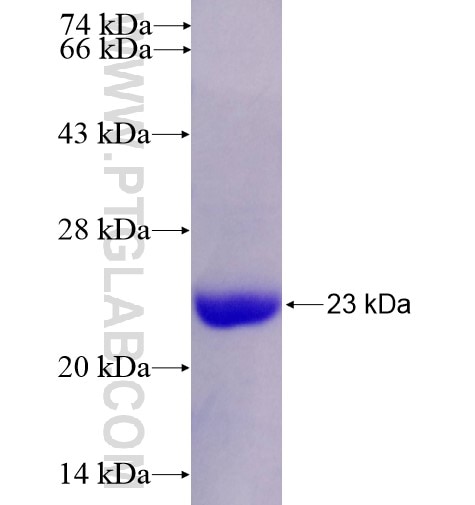 TM9SF3 fusion protein Ag10661 SDS-PAGE