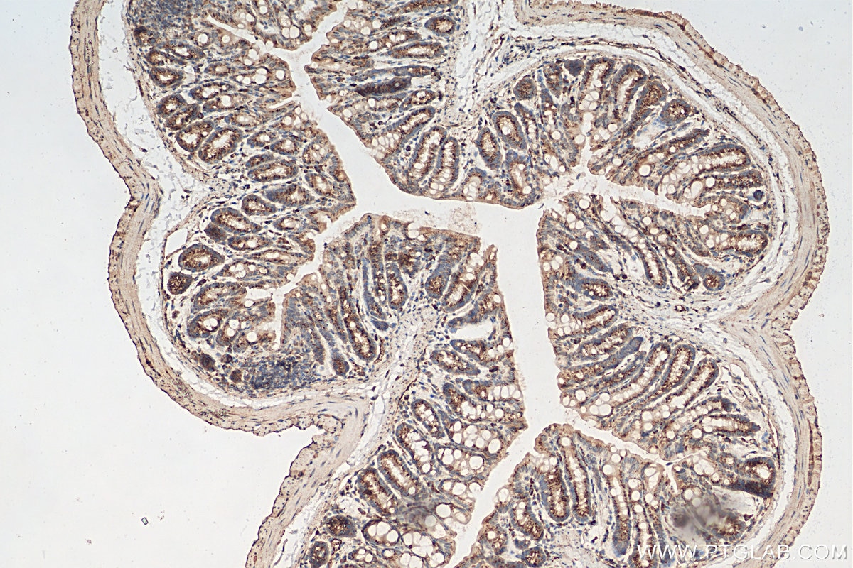 Immunohistochemistry (IHC) staining of mouse colon tissue using TM9SF4 Polyclonal antibody (25595-1-AP)