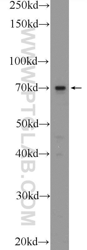 Western Blot (WB) analysis of A431 cells using TM9SF4 Polyclonal antibody (25595-1-AP)