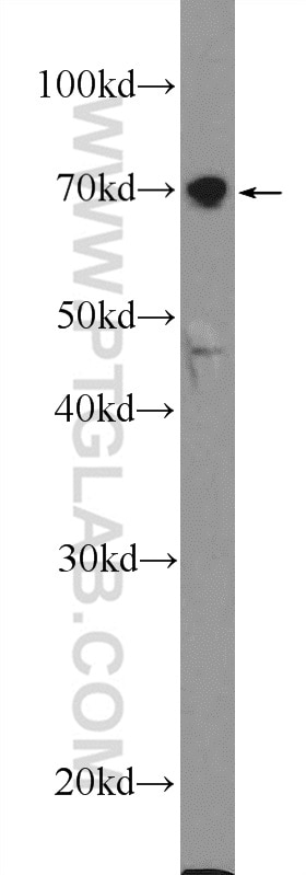Western Blot (WB) analysis of A375 cells using TM9SF4 Polyclonal antibody (25595-1-AP)