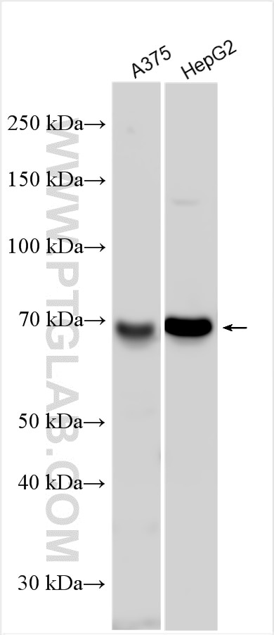 Western Blot (WB) analysis of various lysates using TM9SF4 Polyclonal antibody (25595-1-AP)