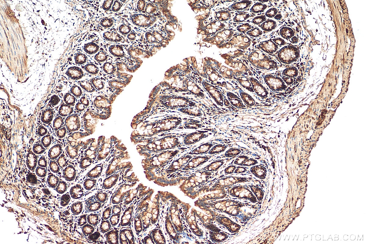 Immunohistochemistry (IHC) staining of mouse colon tissue using TM9SF4 Polyclonal antibody (29520-1-AP)