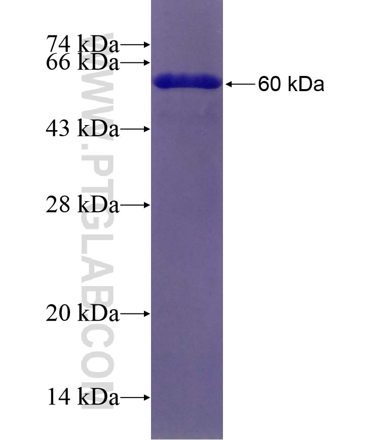 TM9SF4 fusion protein Ag22335 SDS-PAGE