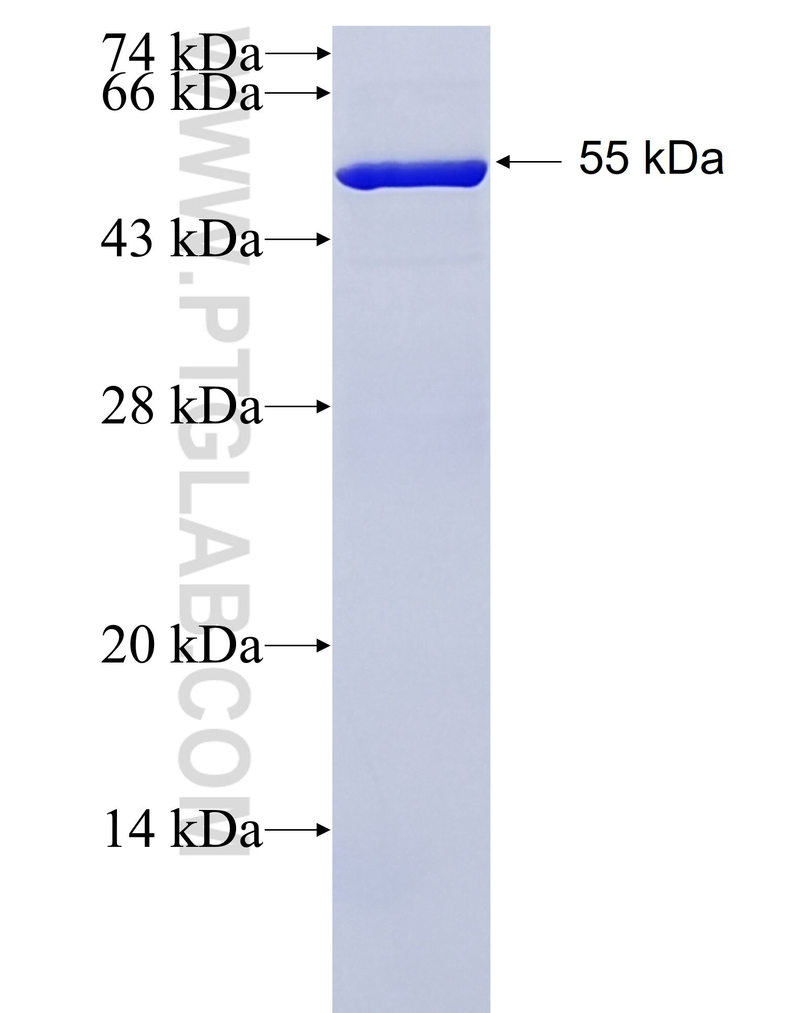 TM9SF4 fusion protein Ag22335 SDS-PAGE