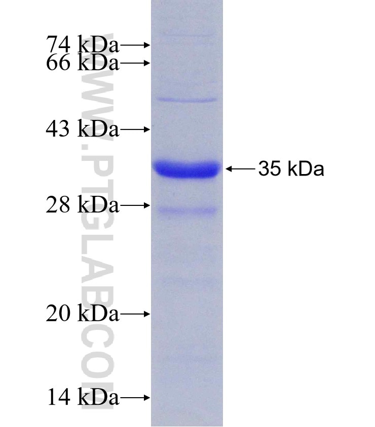 TM9SF4 fusion protein Ag22381 SDS-PAGE