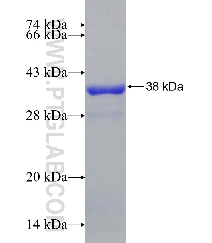 TM9SF4 fusion protein Ag31253 SDS-PAGE