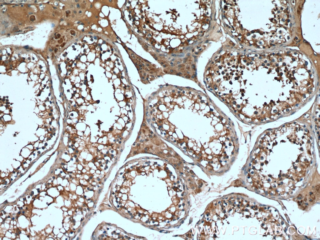 Immunohistochemistry (IHC) staining of human testis tissue using TMBIM6 Polyclonal antibody (26782-1-AP)