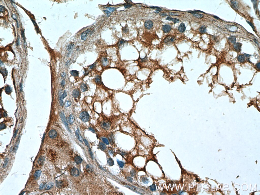 Immunohistochemistry (IHC) staining of human testis tissue using TMBIM6 Polyclonal antibody (26782-1-AP)