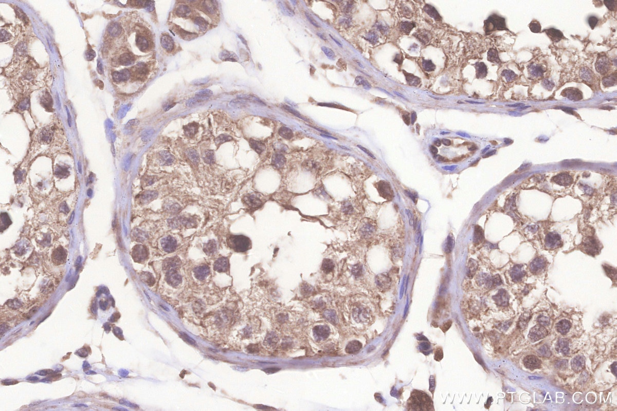 IHC staining of human testis using 26782-1-AP Immunohistochemistry (IHC) staining of human testis tissue using TMBIM6 Polyclonal antibody (26782-1-AP)
