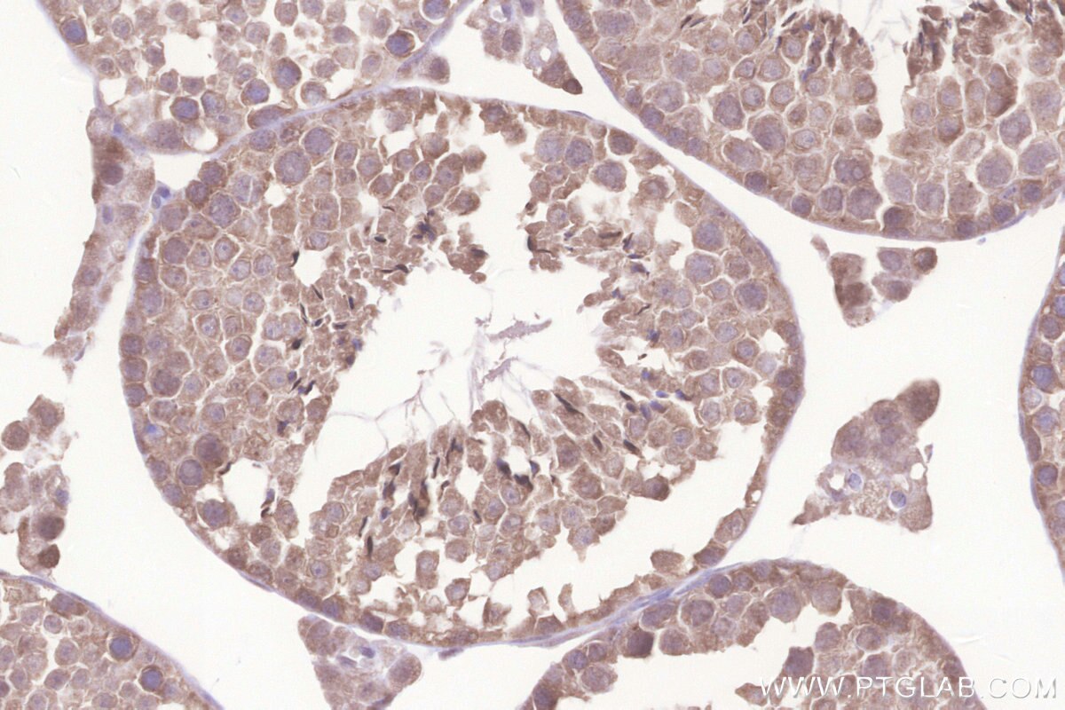 IHC staining of mouse testis using 26782-1-AP Immunohistochemistry (IHC) staining of mouse testis tissue using TMBIM6 Polyclonal antibody (26782-1-AP)