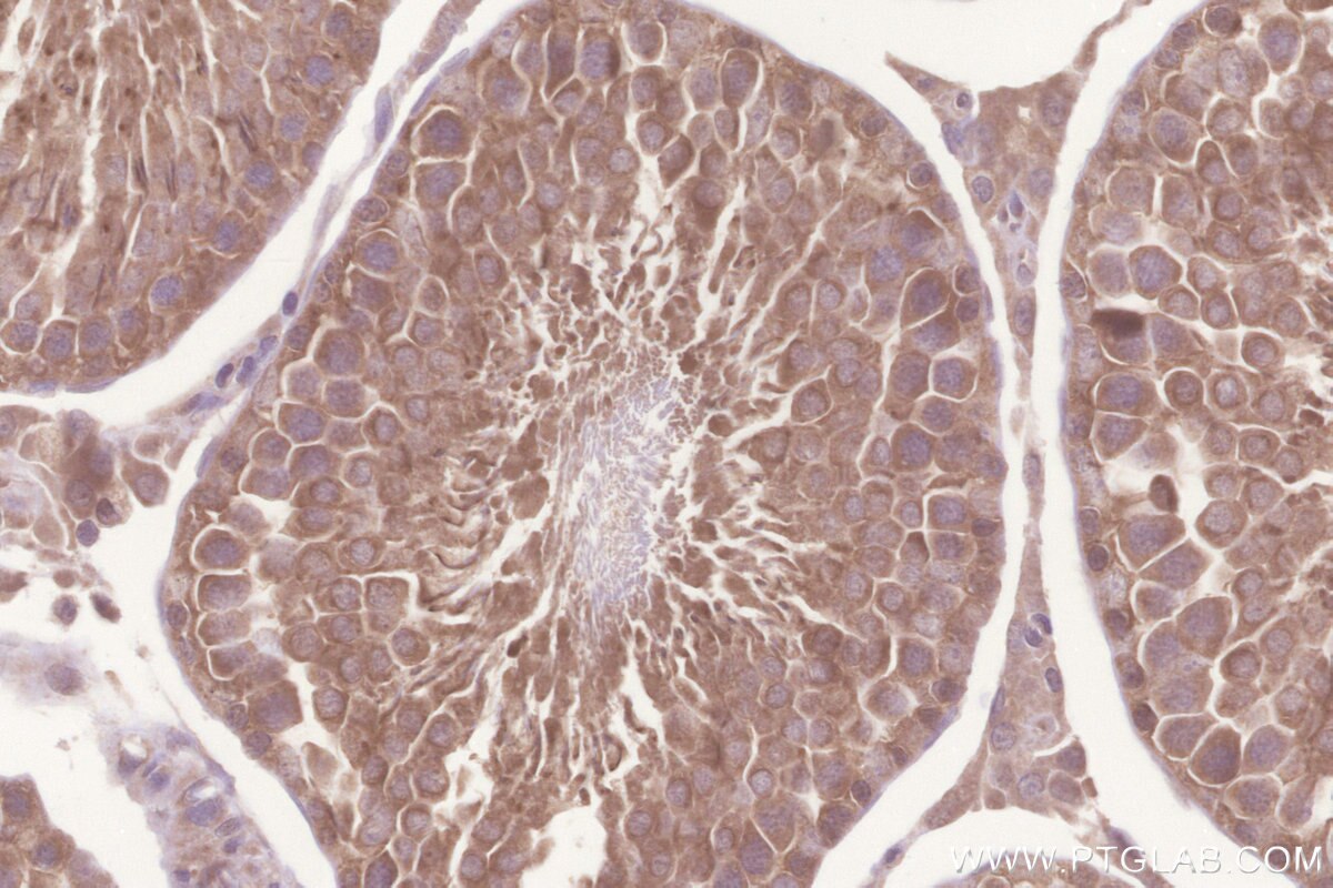 IHC staining of rat testis using 26782-1-AP Immunohistochemistry (IHC) staining of rat testis tissue using TMBIM6 Polyclonal antibody (26782-1-AP)