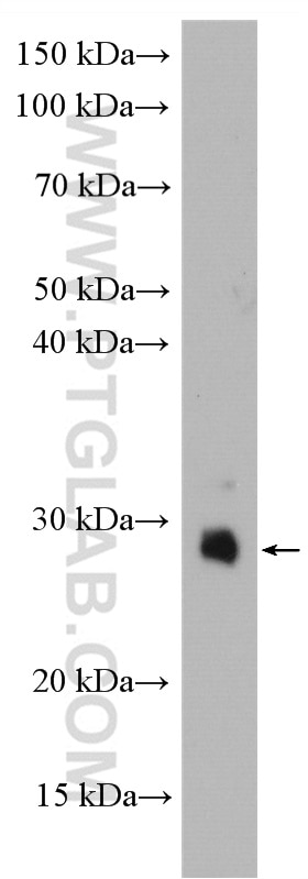 Western Blot (WB) analysis of mouse liver tissue using TMBIM6 Polyclonal antibody (26782-1-AP)