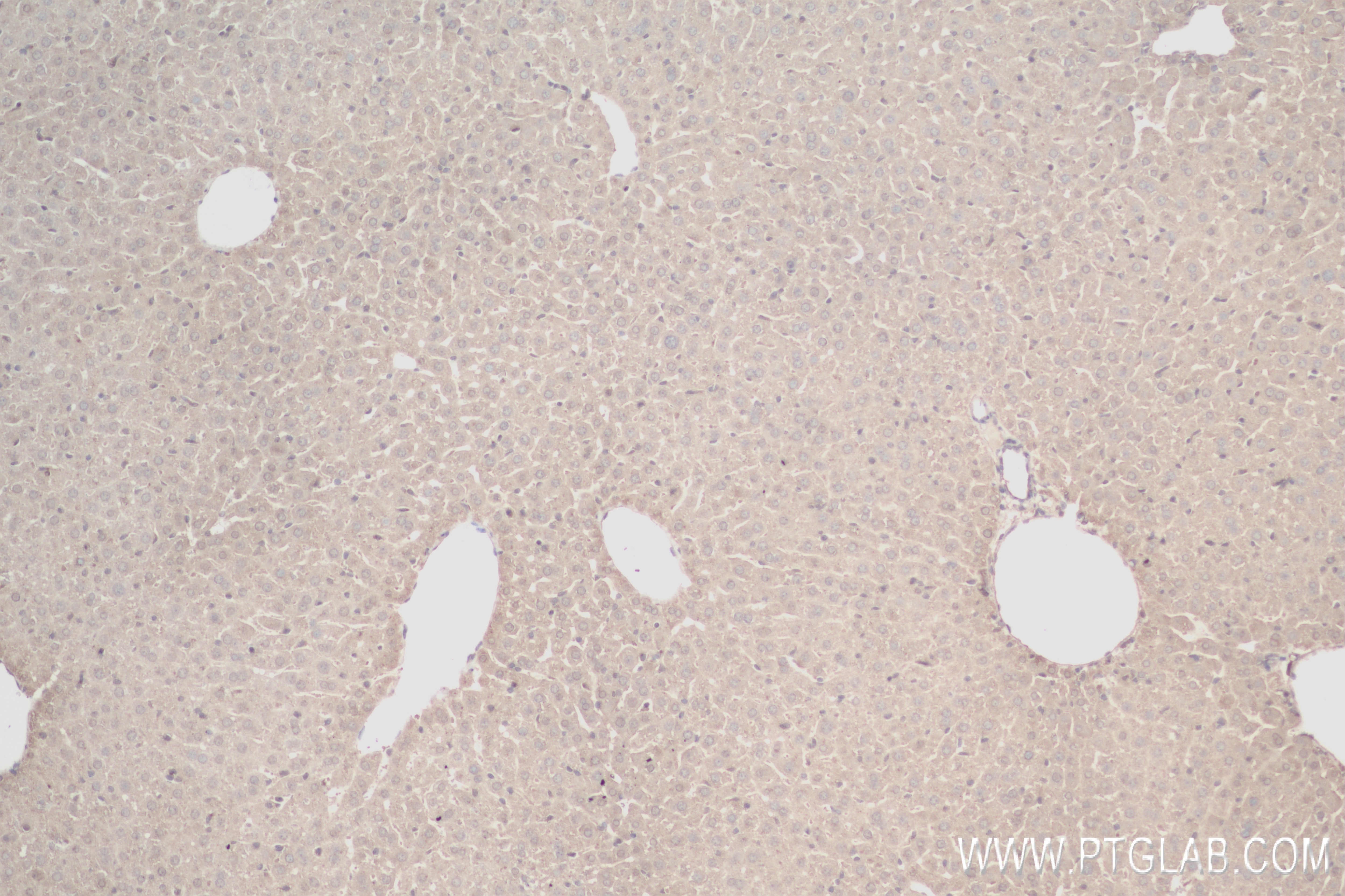 Immunohistochemistry (IHC) staining of mouse liver tissue using TMBIM6 Recombinant antibody (84499-1-RR)