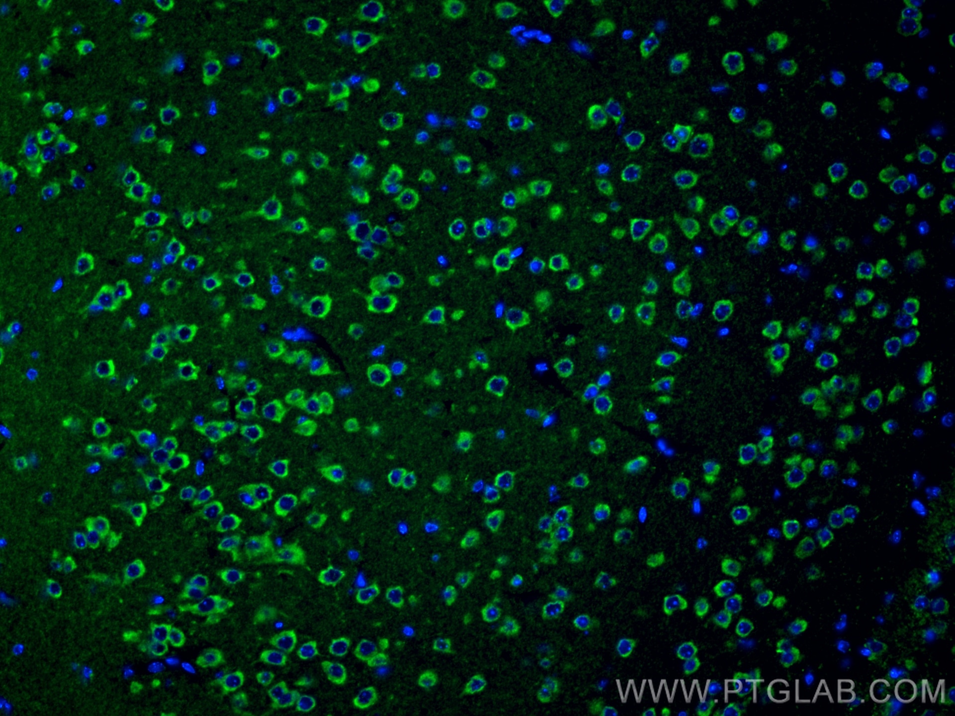 Immunofluorescence (IF) / fluorescent staining of mouse brain tissue using TMC1 Polyclonal antibody (20718-1-AP)