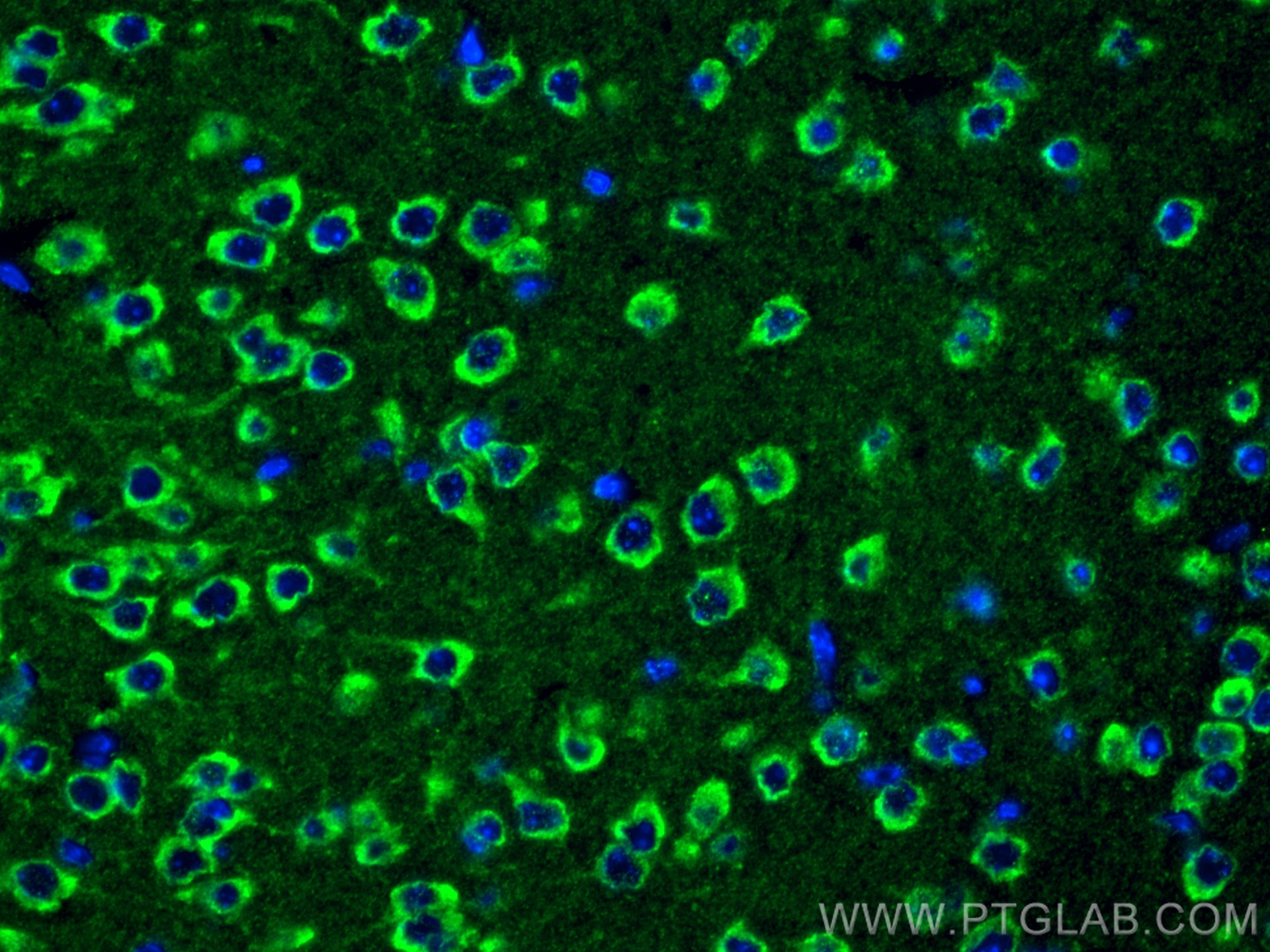 Immunofluorescence (IF) / fluorescent staining of mouse brain tissue using TMC1 Polyclonal antibody (20718-1-AP)