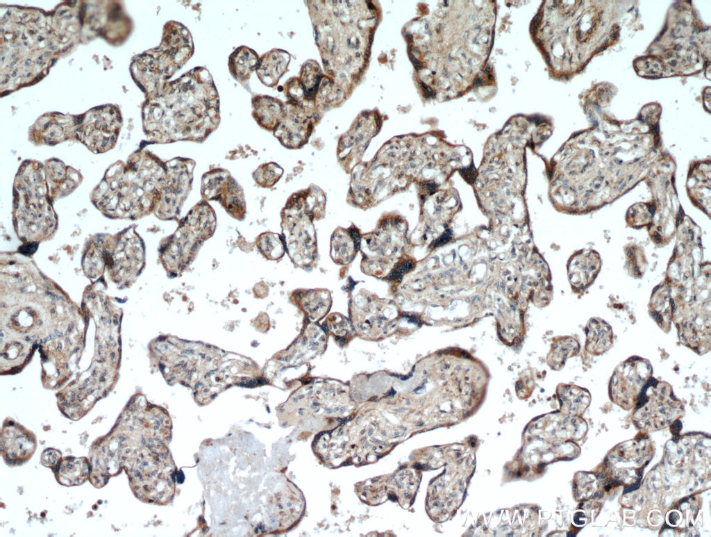 Immunohistochemistry (IHC) staining of human placenta tissue using TMC1 Polyclonal antibody (20718-1-AP)