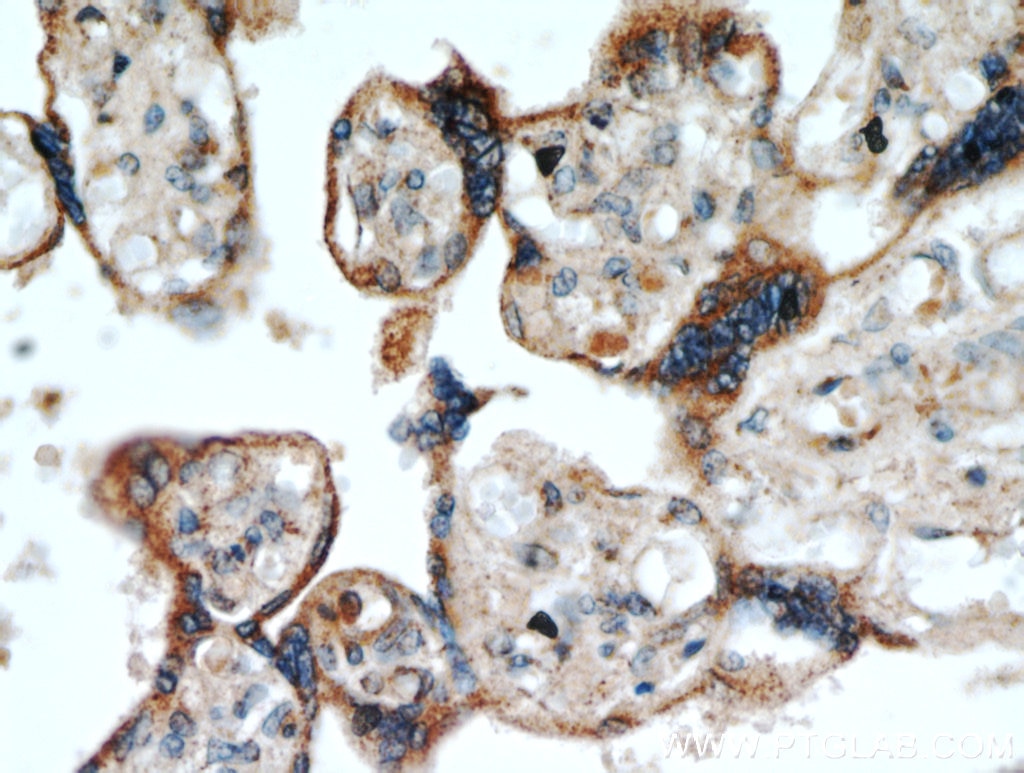 Immunohistochemistry (IHC) staining of human placenta tissue using TMC1 Polyclonal antibody (20718-1-AP)