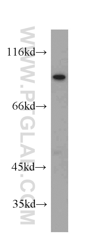 WB analysis of mouse brain using 20718-1-AP