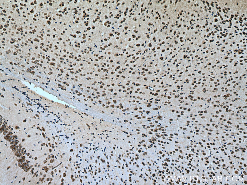 Immunohistochemistry (IHC) staining of mouse brain tissue using TMC2 Polyclonal antibody (27618-1-AP)