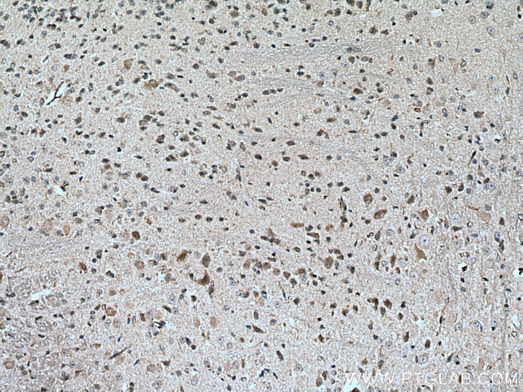 Immunohistochemistry (IHC) staining of mouse cerebellum tissue using TMC2 Polyclonal antibody (27618-1-AP)