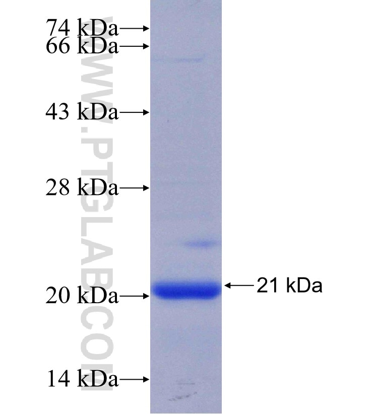 TMC4 fusion protein Ag28110 SDS-PAGE TMC4 fusion protein Ag28110 SDS-PAGE