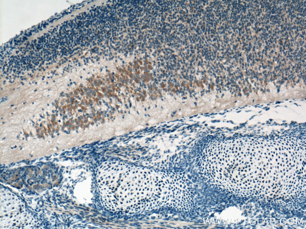 Immunohistochemistry (IHC) staining of mouse embryo tissue using TMCC1 Polyclonal antibody (21099-1-AP)