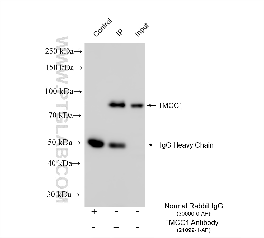 Immunoprecipitation (IP) experiment of MCF-7 cells using TMCC1 Polyclonal antibody (21099-1-AP)