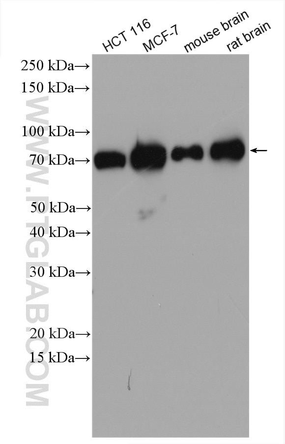 Western Blot (WB) analysis of various lysates using TMCC1 Polyclonal antibody (21099-1-AP)