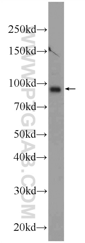 Western Blot (WB) analysis of mouse brain tissue using TMCC2 Polyclonal antibody (25042-1-AP)