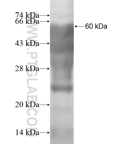 TMCC2 fusion protein Ag19083 SDS-PAGE