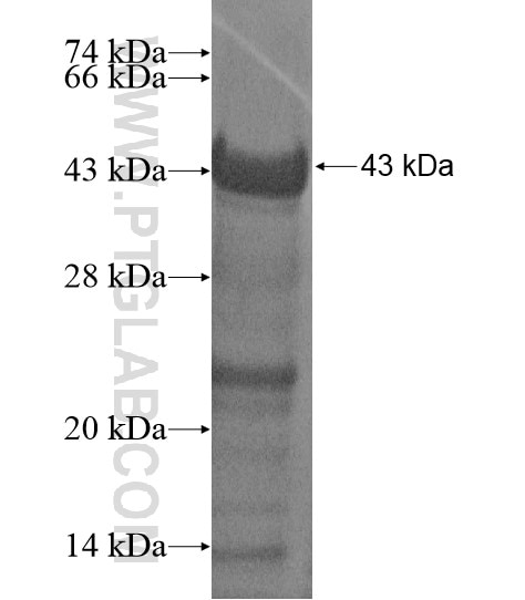 TMCC2 fusion protein Ag19918 SDS-PAGE