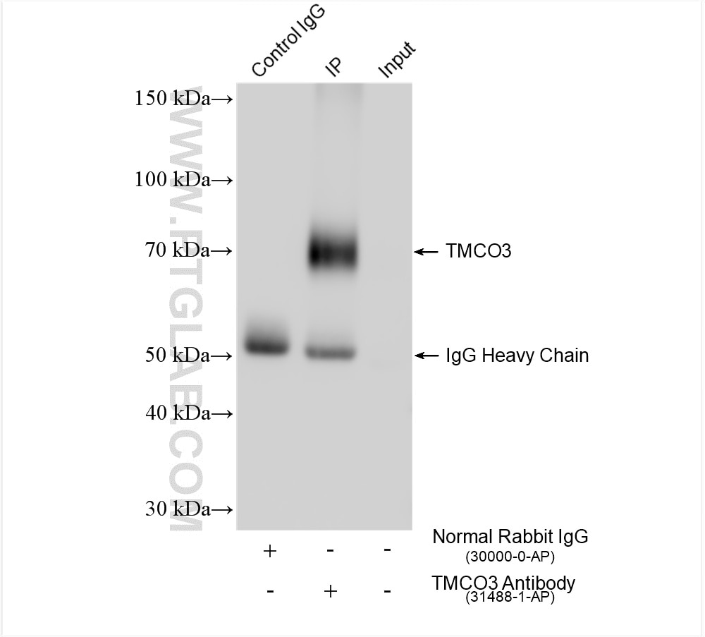 IP experiment of HepG2 using 31488-1-AP Immunoprecipitation (IP) experiment of HepG2 cells using TMCO3 Polyclonal antibody (31488-1-AP)