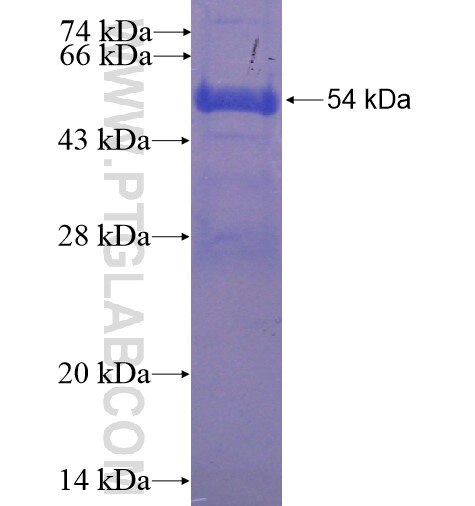 TMCO5A fusion protein Ag15032 SDS-PAGE TMCO5A fusion protein Ag15032 SDS-PAGE