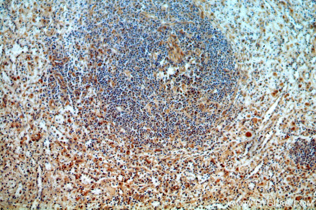 Immunohistochemistry (IHC) staining of human spleen tissue using TMCO6 Polyclonal antibody (20117-1-AP)