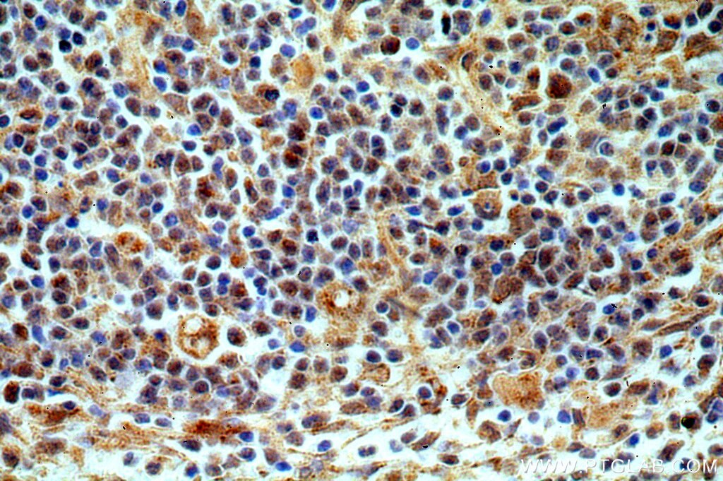 Immunohistochemistry (IHC) staining of human spleen tissue using TMCO6 Polyclonal antibody (20117-1-AP)