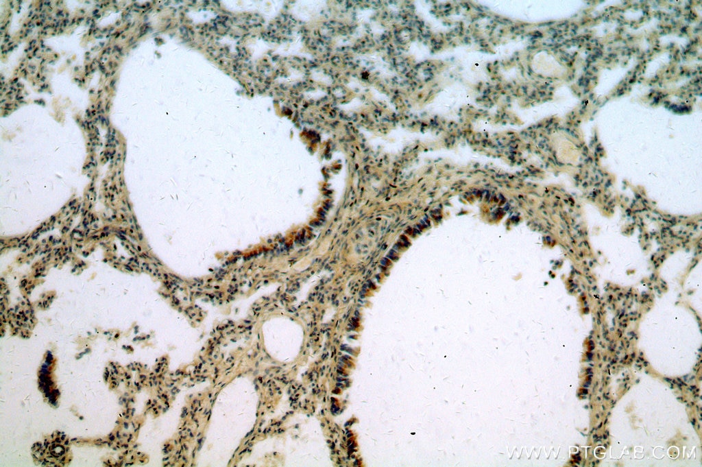Immunohistochemistry (IHC) staining of human lung tissue using TMCO6 Polyclonal antibody (20117-1-AP)