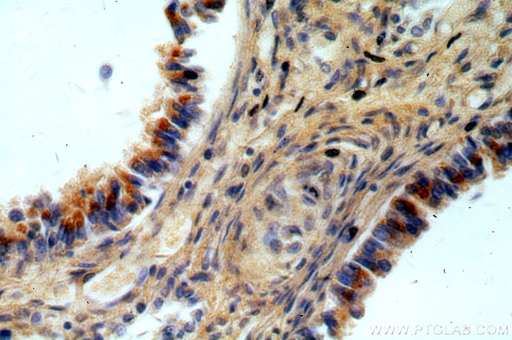 Immunohistochemistry (IHC) staining of human lung tissue using TMCO6 Polyclonal antibody (20117-1-AP)