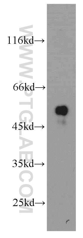 Western Blot (WB) analysis of mouse brain tissue using TMCO6 Polyclonal antibody (20117-1-AP)