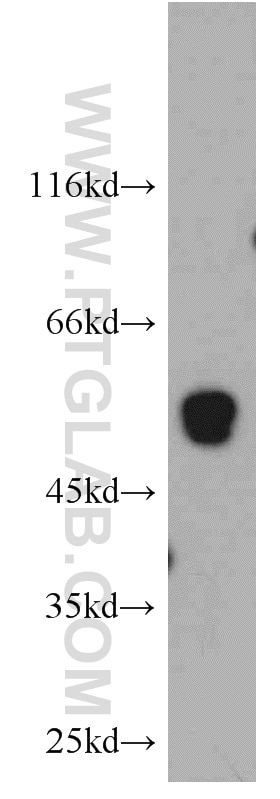 Western Blot (WB) analysis of human testis tissue using TMCO6 Polyclonal antibody (20117-1-AP)