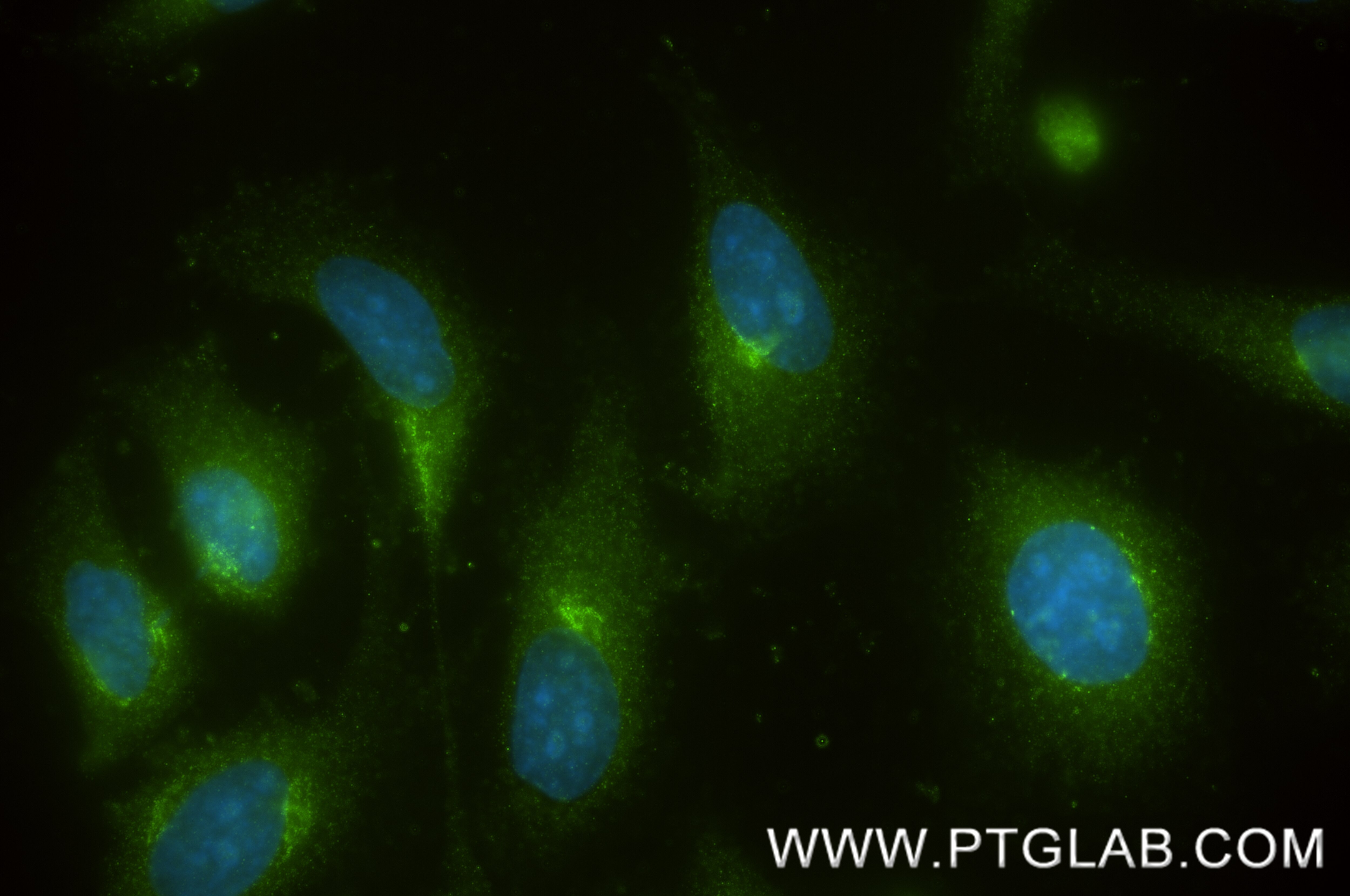 IF Staining of HeLa using 87837-1-RR (same clone as 87837-1-PBS) Immunofluorescence (IF) / fluorescent staining of HeLa cells using TMED1 Recombinant monoclonal antibody (87837-1-RR)