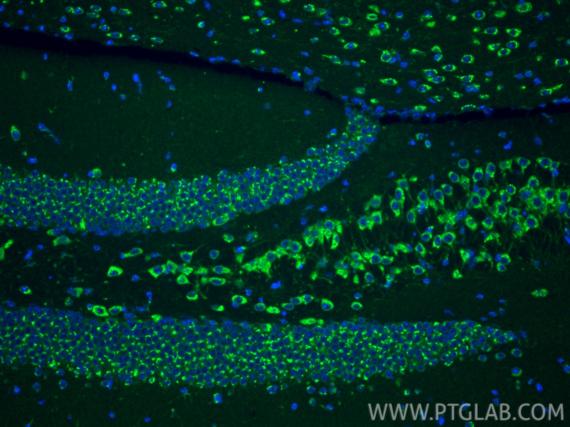 IF Staining of mouse brain using 15199-1-AP Immunofluorescence (IF) / fluorescent staining of mouse brain tissue using TMP21 Polyclonal antibody (15199-1-AP)