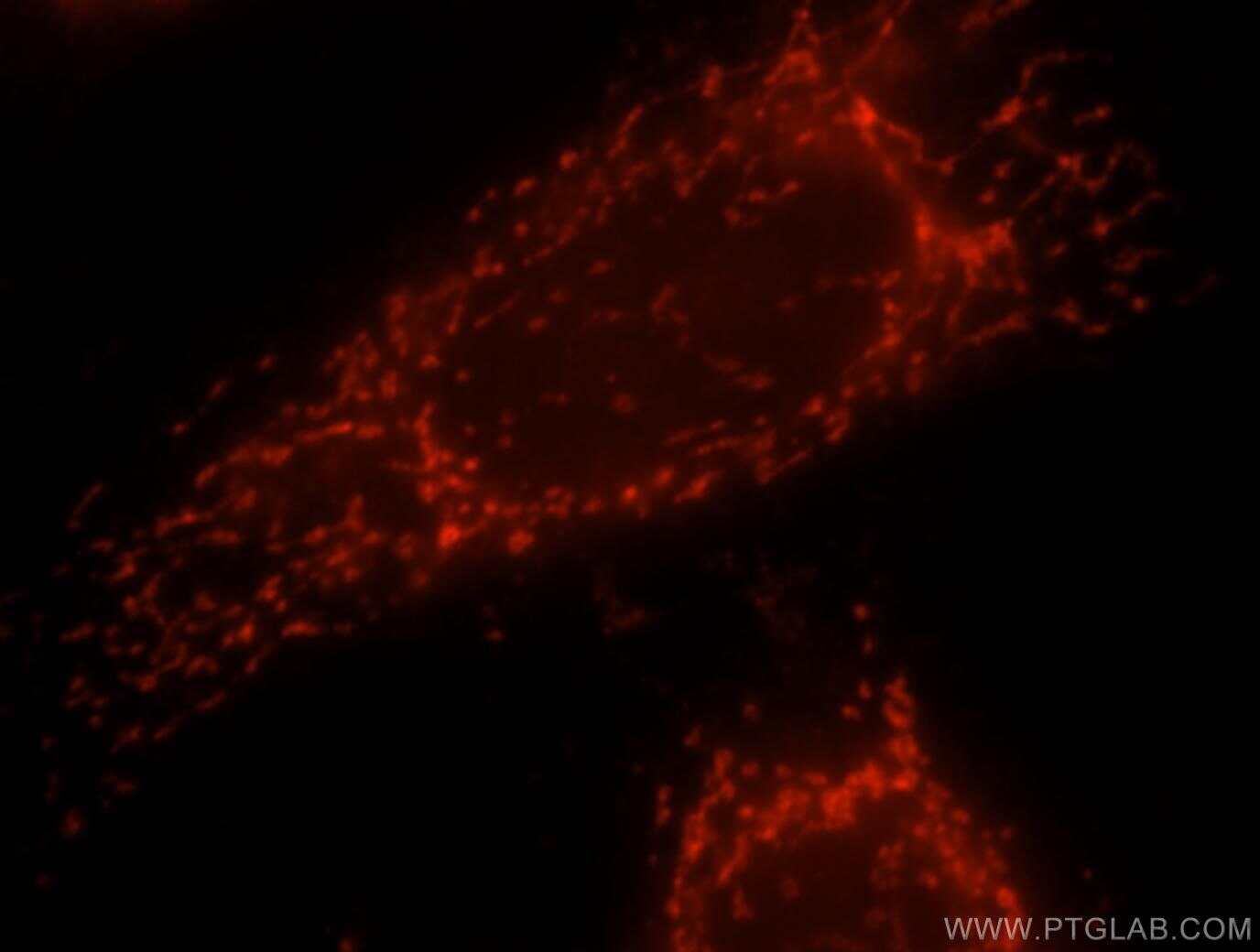 Immunofluorescence (IF) / fluorescent staining of HeLa cells using TMP21 Polyclonal antibody (15199-1-AP)