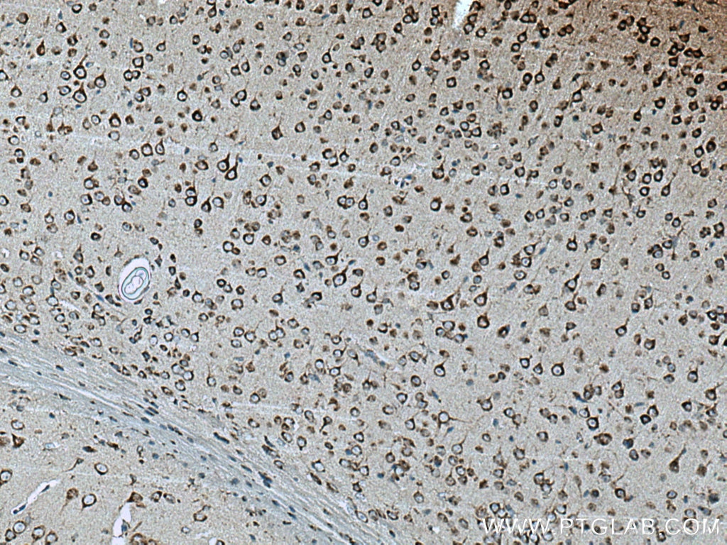 Immunohistochemistry (IHC) staining of mouse brain tissue using TMP21 Polyclonal antibody (15199-1-AP)
