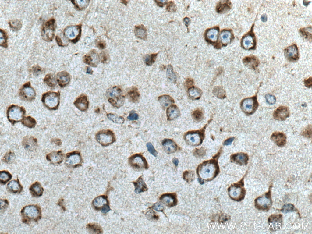 Immunohistochemistry (IHC) staining of mouse brain tissue using TMP21 Polyclonal antibody (15199-1-AP)