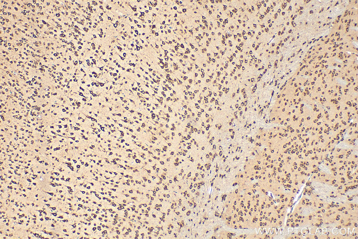 Immunohistochemistry (IHC) staining of mouse brain tissue using TMP21 Polyclonal antibody (15199-1-AP)