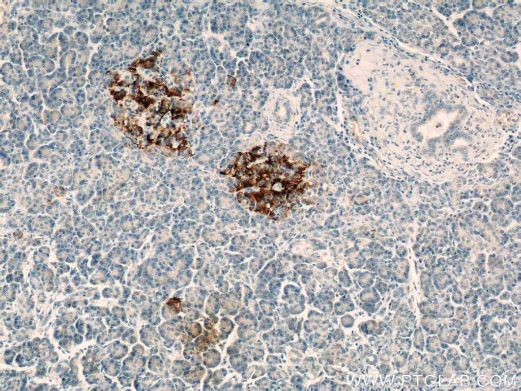 Immunohistochemistry (IHC) staining of human pancreas tissue using TMP21 Polyclonal antibody (15199-1-AP)